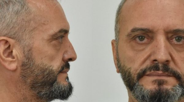 Σεπόλια: Αποκλειστικό MEGA: Ολόκληρη η φρικιαστική απολογία του Ηλία Μίχου – Επιμένει στη «συναίνεση» της 12χρονης