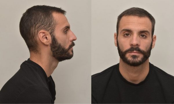 Αγρίνιο: Σοκαρισμένος ο προπονητής του 28χρονου που κατηγορείται για ασέλγεια