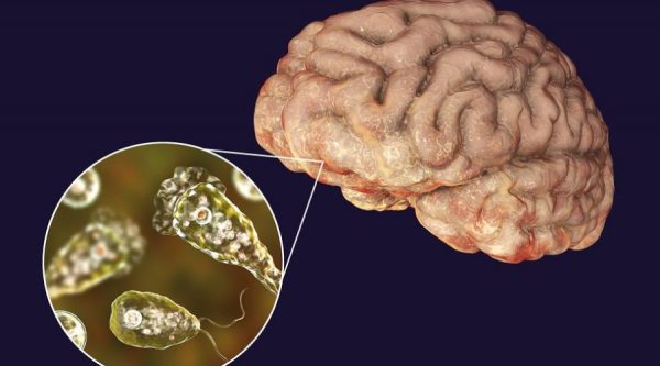 ΗΠΑ: Ανήλικος πέθανε από ναιγλερίαση, μια λοίμωξη που προκαλείται από σπάνια αμοιβάδα