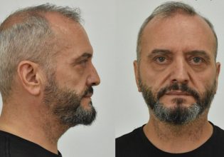 Σεπόλια: Χυδαιότητα από τον πατέρα του Μίχου για τη 12χρονη – «Άμα του κουνιόταν κάτι θα έκανε»