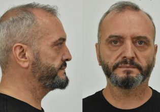 Σεπόλια: Αυτός είναι ο 53χρονος που βίαζε και εξέδιδε το 12χρονο παιδί