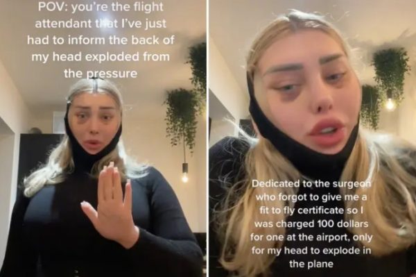 Μοντέλο του OnlyFans έκανε πλαστική επέμβαση και «εξερράγη» το κεφάλι της