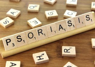 Ψωρίαση: Οι νέες θεραπείες αναστέλλουν και τη συννοσηρότητα