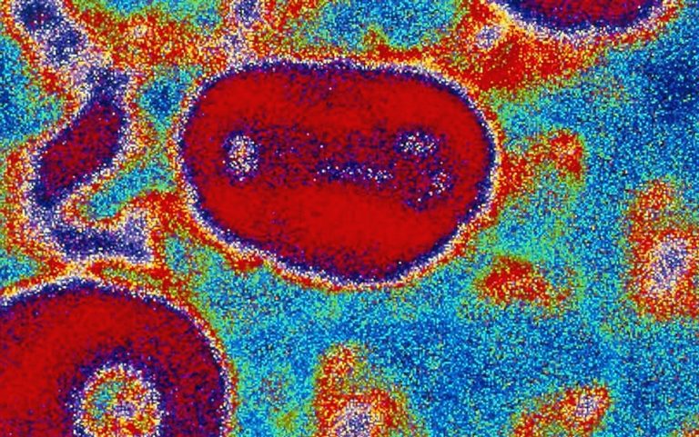 Ευλογιά των πιθήκων: Νέα ουσία ίσως βάζει φρένο στη λοίμωξη