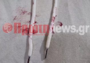 Ηλεία: Στο χειρουργείο 13χρονη μετά από χτύπημα που δέχτηκε από τον ίδιο της τον πατέρα