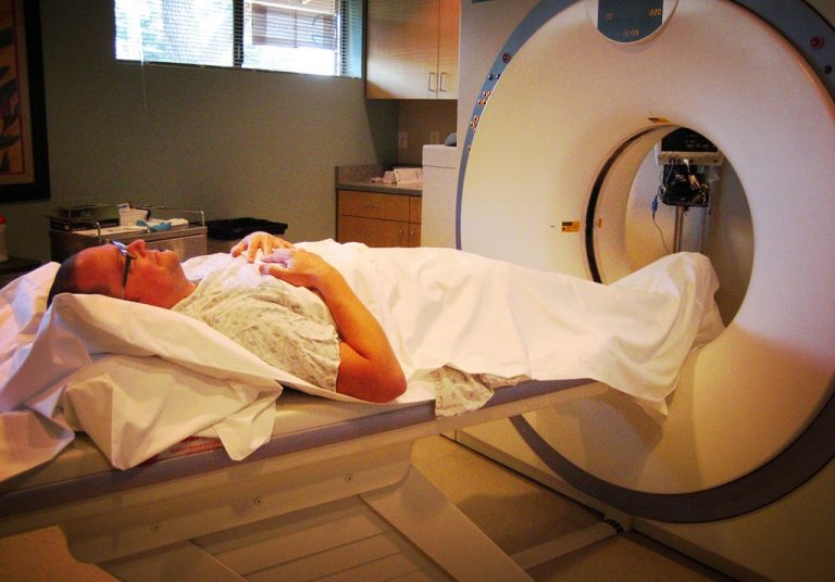Καρκίνος του πνεύμονα: Η προληπτική αξονική χαμηλής ακτινοβολίας σώζει ζωές