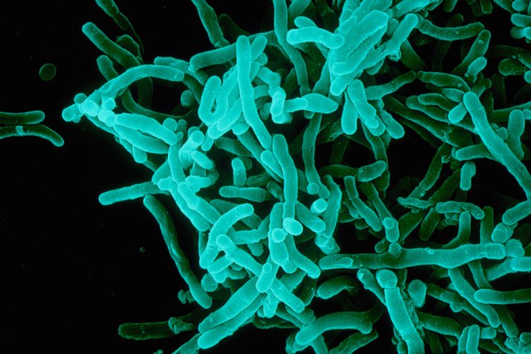 Ανθεκτικές λοιμώξεις: Η Ελλάδα πρώτη στην Ευρώπη  – Έκρηξη κρουσμάτων λόγω πανδημίας