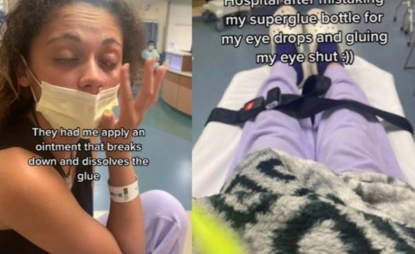 Νεαρή κατέληξε στα επείγοντα όταν… μπέρδεψε το κολλύριο της με σούπερ κόλλα