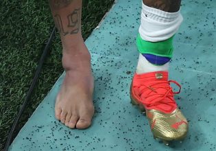 Μουντιάλ 2022: Ο πρησμένος αστράγαλος του Νεϊμάρ από τον τραυματισμό που υπέστη