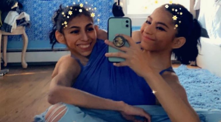 Σιαμαίες 21 ετών, μιλούν για την κοινή τους ζωή: Η Κάρμεν έχει αγόρι, η Λουπίτα είναι ασεξουέλ