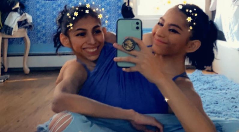 Σιαμαίες 21 ετών, μιλούν για την κοινή τους ζωή: Η Κάρμεν έχει αγόρι, η Λουπίτα είναι ασεξουέλ