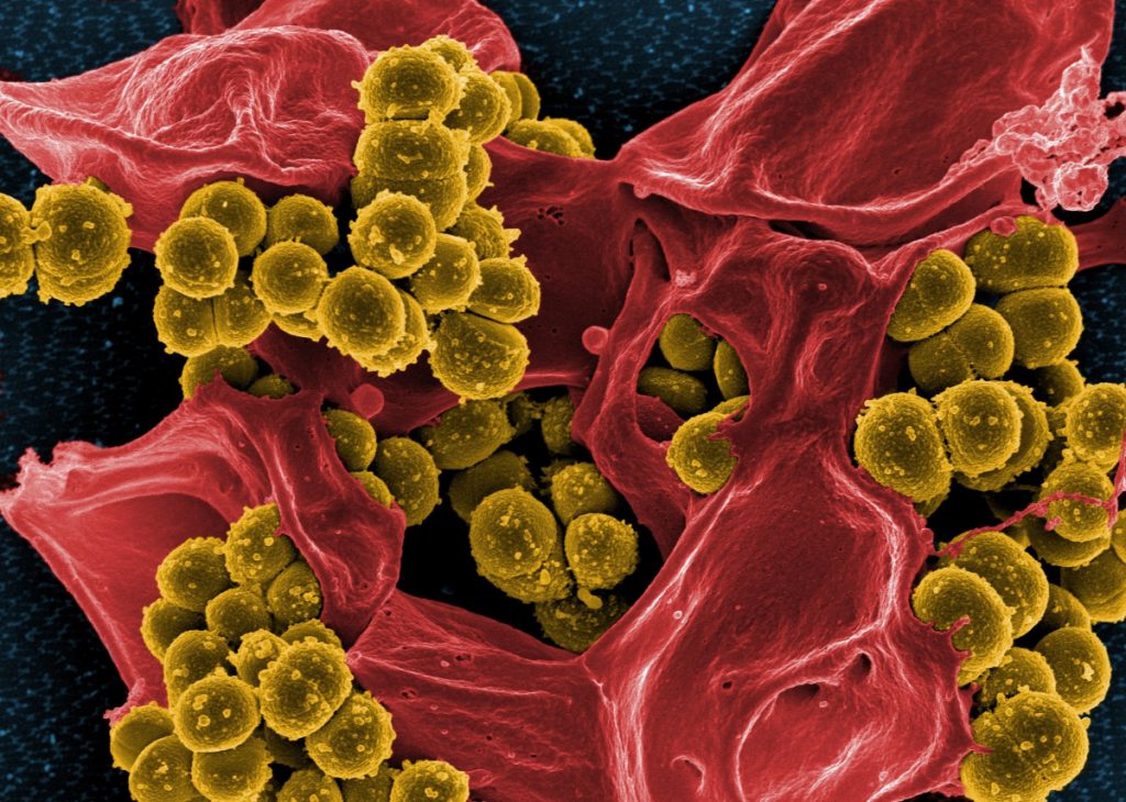 Καρκίνος: Πληθαίνουν οι ενδείξεις για εμπλοκή μικροβίων στο σχηματισμό όγκων και τη μετάσταση