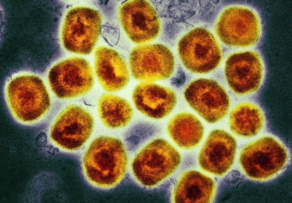 Ευλογιά των πιθήκων: Ο ιός γίνεται «εξυπνότερος»