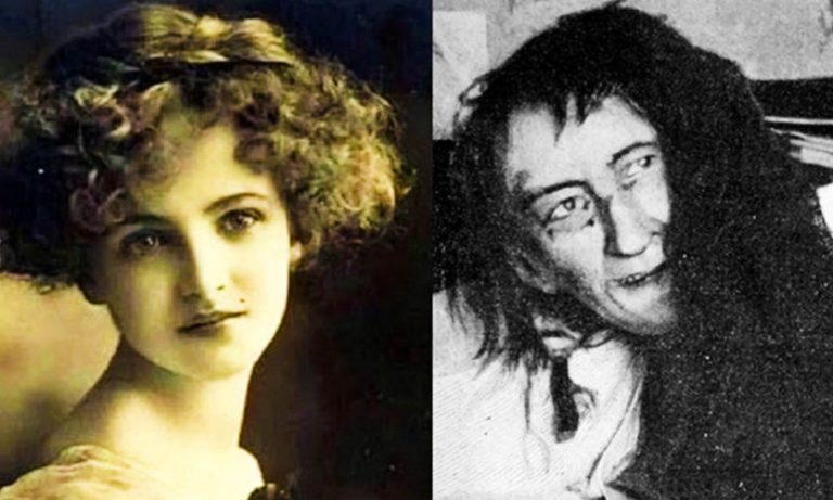 Ένα «Κωσταλέξι»… εποχής: Ζούσε σε ένα υπόγειο μέσα στα σκουπίδια 25 χρόνια επειδή αγάπησε λάθος άντρα