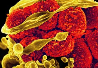 Εκατομμύρια θάνατοι κάθε χρόνο από τη μικροβιακή αντοχή