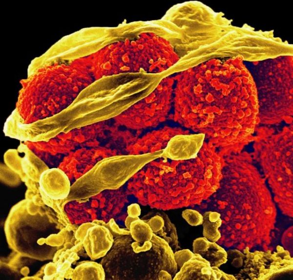 Εκατομμύρια θάνατοι κάθε χρόνο από τη μικροβιακή αντοχή