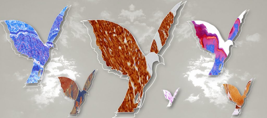 Λιγοστεύουν επικίνδυνα οι παθολογοανατόμοι στην Ελλάδα