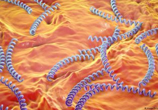 Σεξ: Η σύφιλη μπορεί (ακόμη) να σκοτώσει – Δραματική αύξηση των μολύνσεων