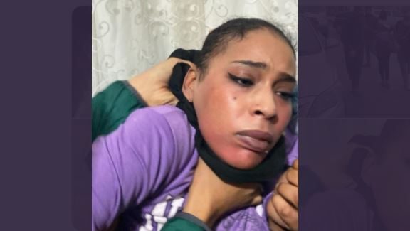 Τουρκία: Νέο βίντεο ντοκουμέντο από την έκρηξη στην Κωνσταντινούπολη – Πλάνα και φωτογραφίες από τη σύλληψη της ύποπτης