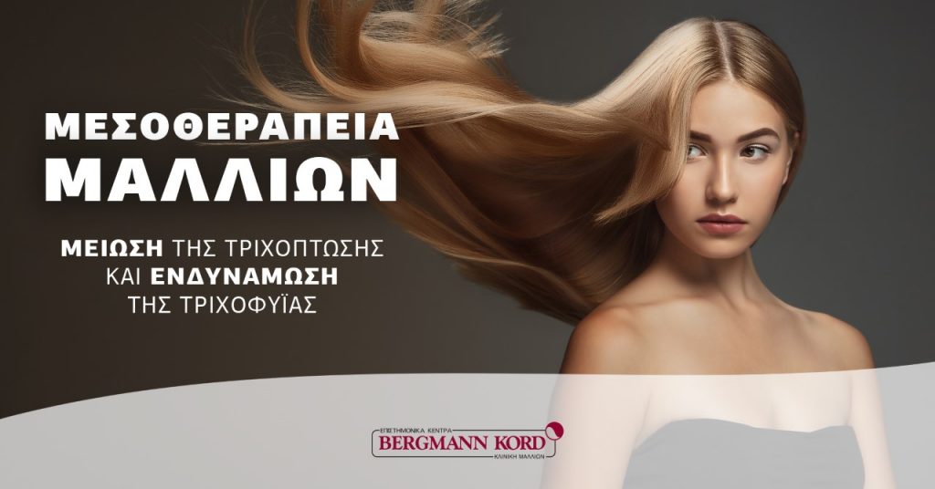 Εχετε τριχόπτωση; Υπάρχει η μεσοθεραπεία μαλλιών με εντυπωσιακά αποτελέσματα