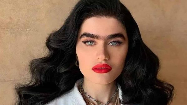 Σοφία Χατζηπαντελή: Έκανε μπότοξ και μας δείχνει το ανανεωμένο της πρόσωπο