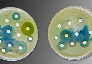 Ένα νέο αντιβιοτικό θα εξοικονομούσε σχεδόν 7 δις από νοσοκομειακές λοιμώξεις