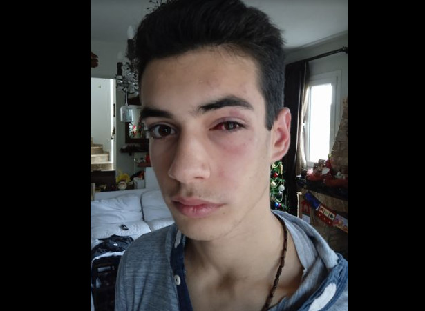 Ξυλοδαρμός 15χρονου στη Χαλκιδική – Η ανάρτηση της μητέρας του
