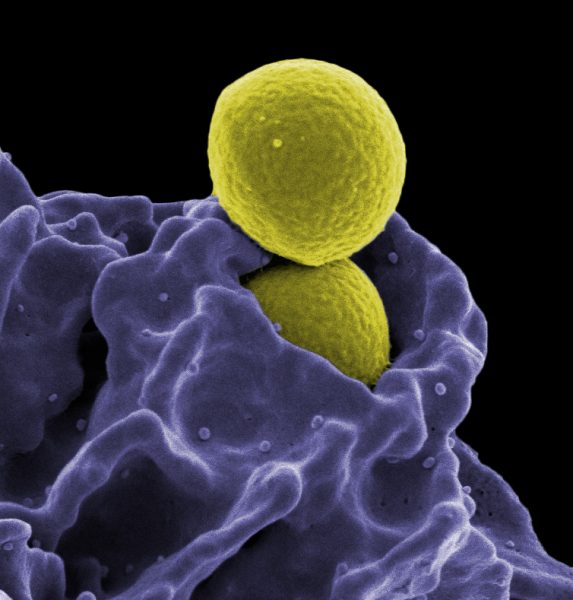 Εξαπλώνεται η μικροβιακή αντοχή και σε απλές λοιμώξεις