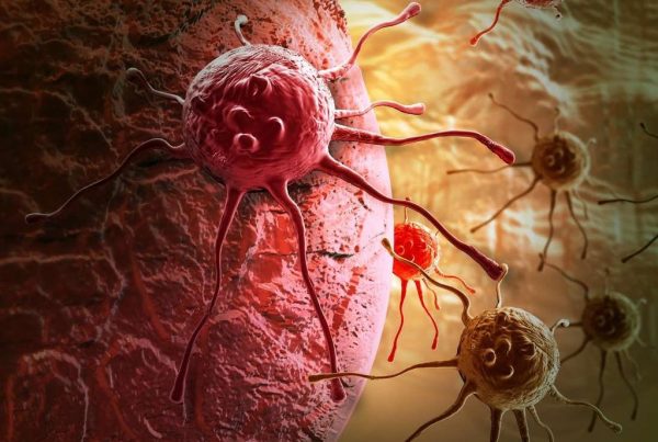 Απαραίτητος ο πολυγονιδιακός έλεγχος για τον καρκίνο του μαστού