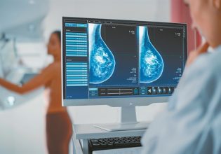 Στο «κυνήγι» θεραπειών για τον τριπλά αρνητικό καρκίνο του μαστού