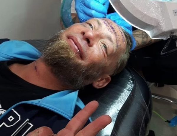 Ξέφυγαν σε μπάτσελορ: Πλήρωσαν άστεγο για να κάνει τατουάζ το όνομα του γαμπρού στο μέτωπό του