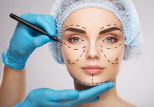 Ξεπέρασε ακόμα και την προσθετική στήθους – Αυτή ήταν η πιο δημοφιλής αισθητική παρέμβαση του 2022