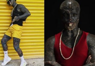 Ευτυχισμένος δηλώνει ο… άνθρωπος «εξωγήινος»: Τον αποδέχεται η μητέρα του