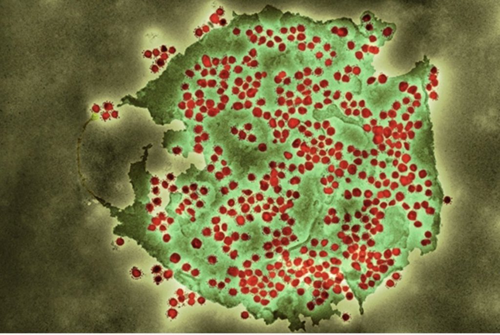 Όρθρος: Νέο στέλεχος του κοροναϊού εξαπλώνεται στην Ευρώπη