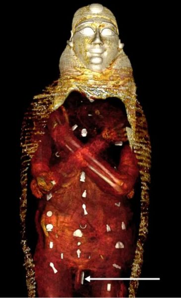 «Ξετυλίγοντας» μια μούμια: Το «Χρυσό Αγόρι» με τα 49 χρυσά φυλακτά – Η ελληνική επιγραφή στον τάφο του