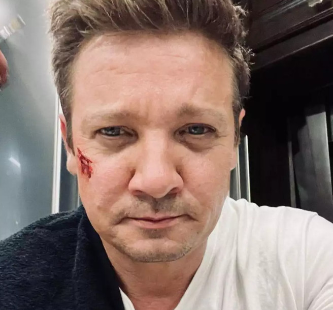 Τζέρεμι Ρένερ: Η σοβαρότητα της κατάστασης της υγείας του