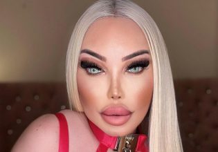 Η ανθρώπινη «Barbie» με τις 103 πλαστικές – Πλήρωσε 650.000 λίρες για να μοιάζει με κούκλα