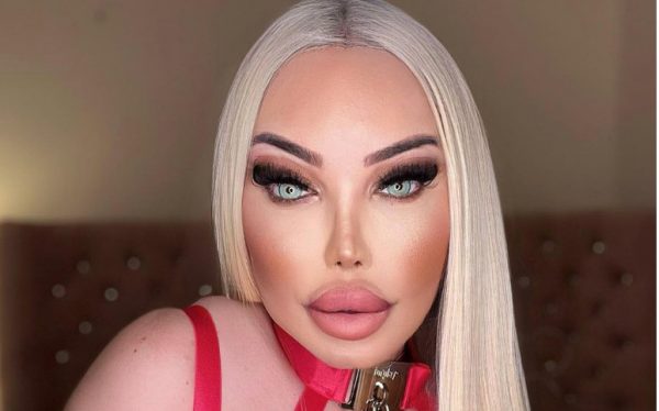 Η ανθρώπινη «Barbie» με τις 103 πλαστικές – Πλήρωσε 650.000 λίρες για να μοιάζει με κούκλα