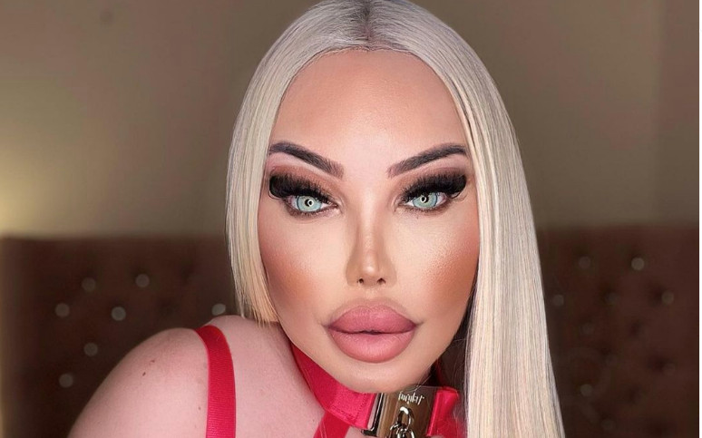 Η ανθρώπινη «Barbie» με τις 103 πλαστικές – Πλήρωσε 650.000 λίρες για να μοιάζει με κούκλα