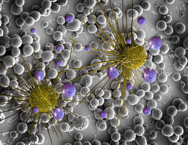 Καρκίνος: Προτάσεις για σχέδιο κατά της αρρώστιας από φορείς ασθενών