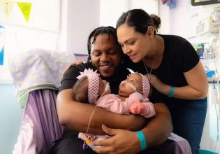 Διαχωρίστηκαν σιαμαία κοριτσάκια στο Τέξας μετά από επέμβαση 11 ωρών