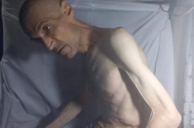 Ιράν: Σοκάρει η εικόνα «σκελετωμένου» γιατρού στο Ιράν  – Κάνει απεργία πείνας στη φυλακή