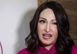 Ιωάννα Παλιοσπύρου: Συστήνει το γιατρό της στο Instagram