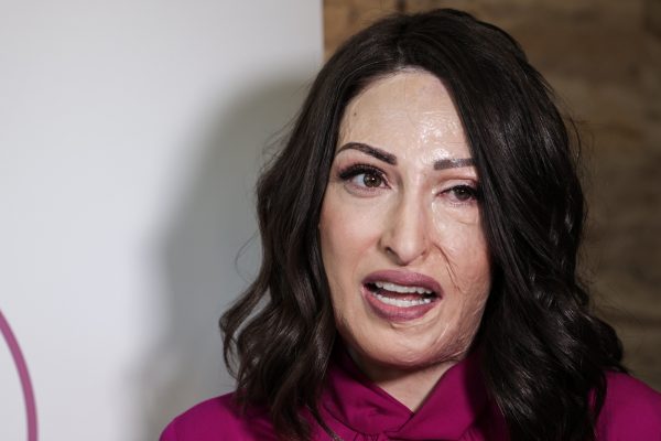 Ιωάννα Παλιοσπύρου: Συστήνει το γιατρό της στο Instagram