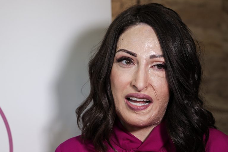 Ιωάννα Παλιοσπύρου: Συστήνει το γιατρό της στο Instagram