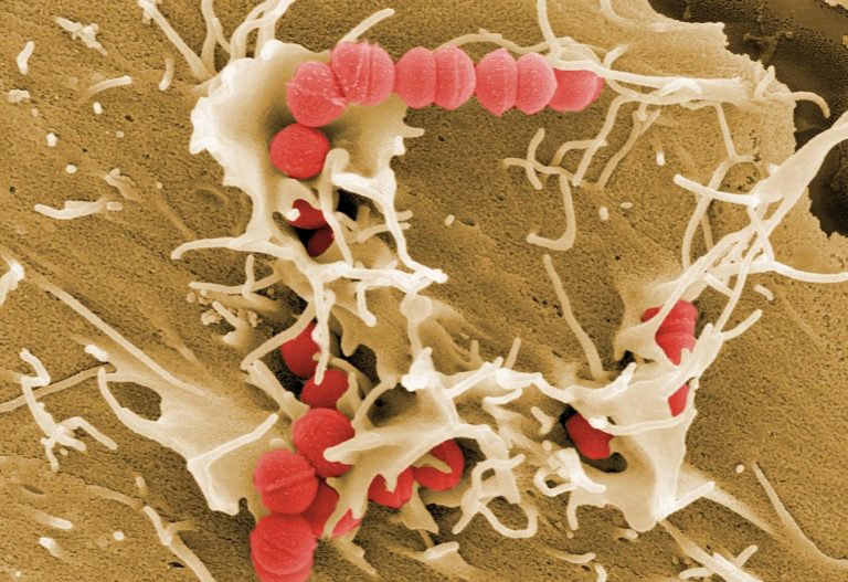 Στρεπτόκοκκος Α: Τι είναι και πώς αντιμετωπίζεται το βακτήριο που προκάλεσε τον θάνατο εξάχρονου στην Ελλάδα