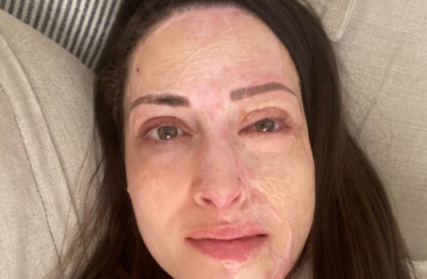 Ιωάννα Παλιοσπύρου: «Ακόμα παλεύω να αποδεχτώ τον νέο μου εαυτό» – Συγκλονιστική ανάρτηση