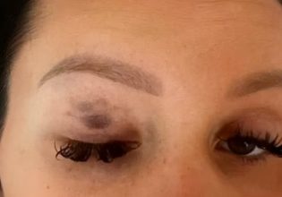 Μεγάλη Βρετανία: Αυτοκτόνησε μητέρα θύμα επανειλημμένης κακοποίησης – Συγκλονίζει το σημείωμα που άφησε [εικόνες σοκ]