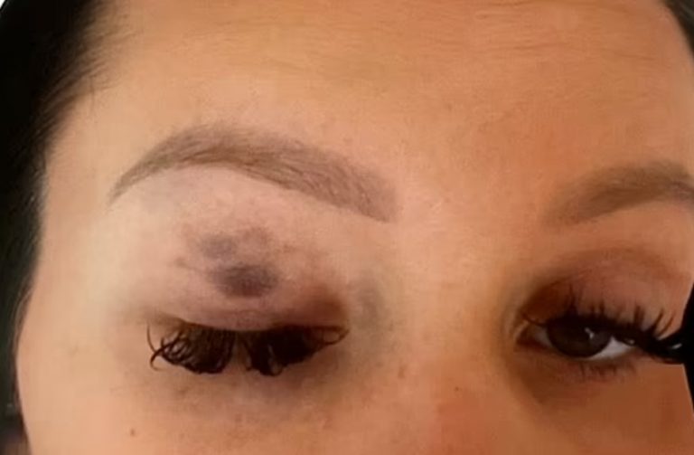 Μεγάλη Βρετανία: Αυτοκτόνησε μητέρα θύμα επανειλημμένης κακοποίησης – Συγκλονίζει το σημείωμα που άφησε [εικόνες σοκ]