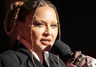 Μαντόνα: Η απάντηση πλαστικού χειρουργού για τη μεταμόφωση